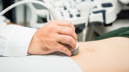 ΥΠΟΓΟΝΙΜΟΤΗΤΑ