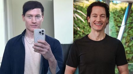 bryan_johnson_arthro