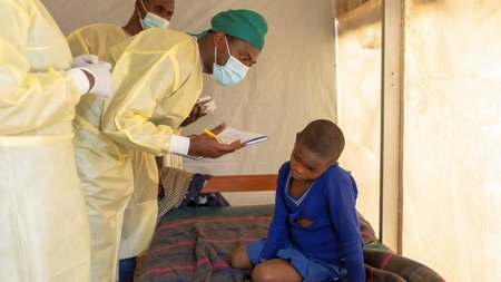 2024-07-24T083627Z_1793037536_RC2ZX8A35HV3_RTRMADP_5_HEALTH-MPOX-CONGO-1024x665