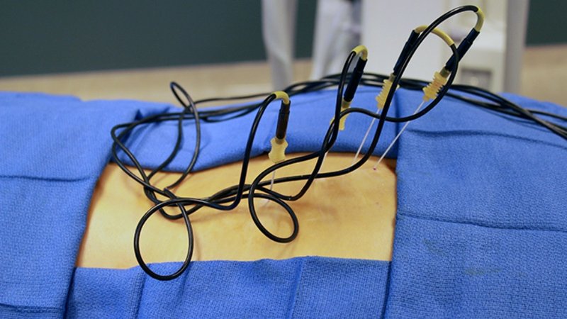 images_thermikh-neurolysh